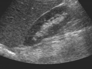 Imagem Integrada Ultrassonografia de uretra masculina no Rio de Janeiro