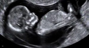 Imagem Integrada Ultrassonografia obstétrica morfológica fetal no Rio do Janeiro