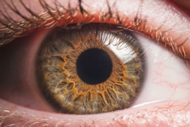 Capsulotomia Yag Laser