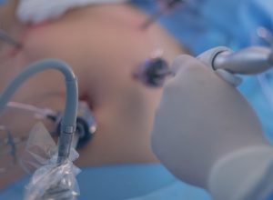 Dra Edione Magda Neri Cirurgia Videolaparoscópica infantil em Brasília
